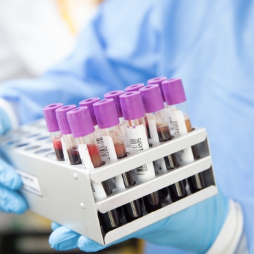 PCR Testing